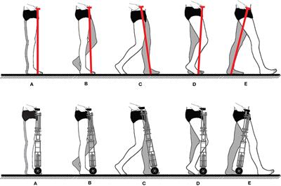 Robotic Cane Controlled to Adapt Automatically to Its User Gait Characteristics
